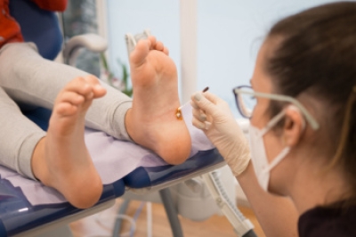 Understanding Plantar Warts