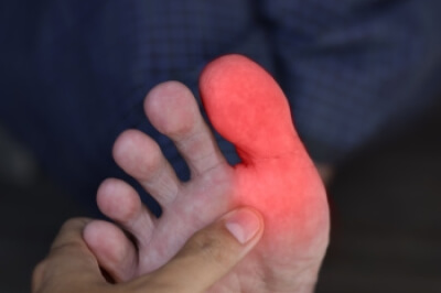 Solving Toe Pain